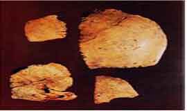 고인;력포사람의 머리뼈화석