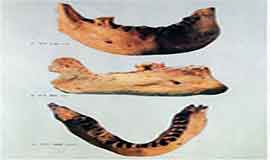 신인;승리산사람의 아래턱뼈